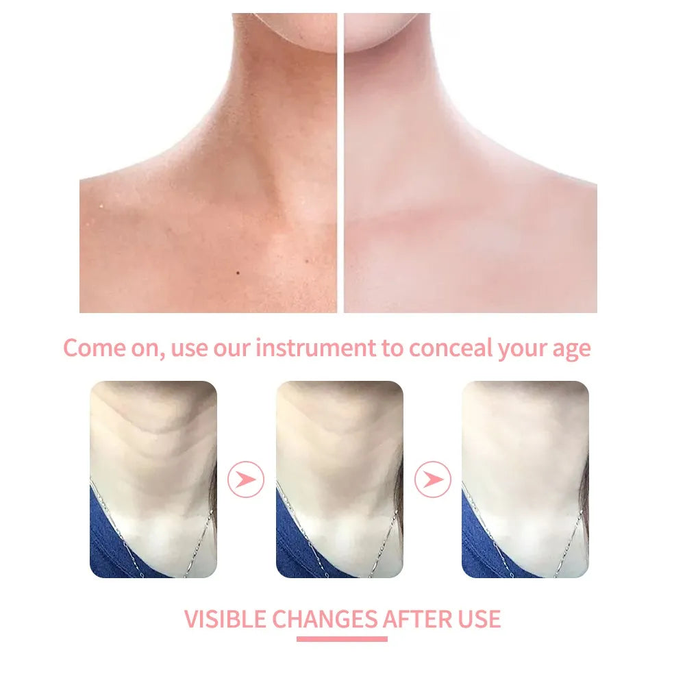 IPL Wrinkle Lift Neck Beauty Device